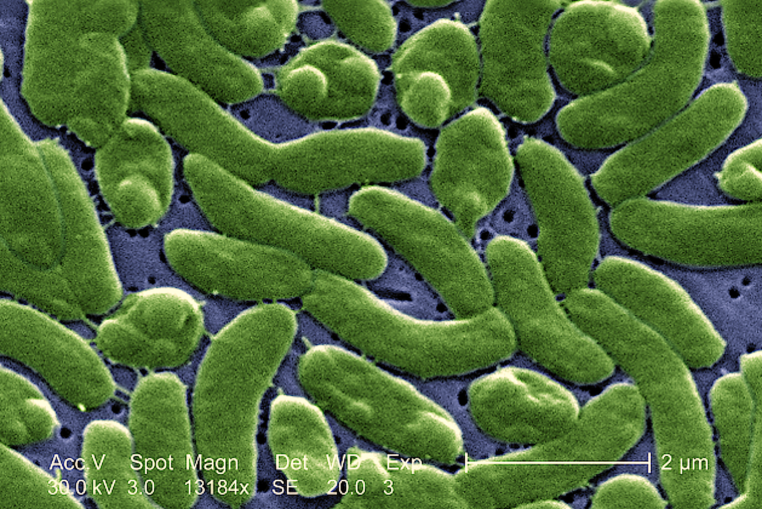 image: microscope's view of Vibrio vulnificus.