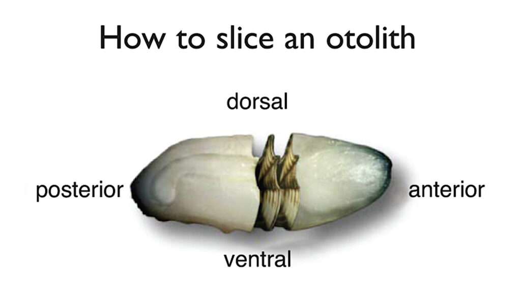 image: otolith with slices.