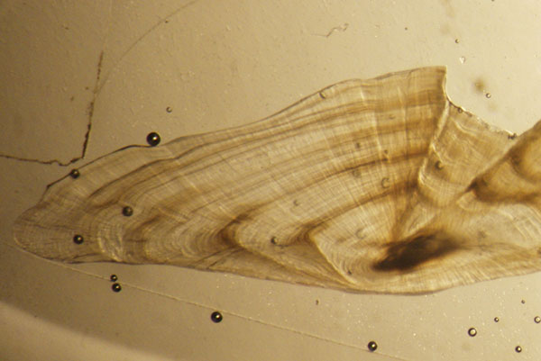View of magnified ear bone, or otolith