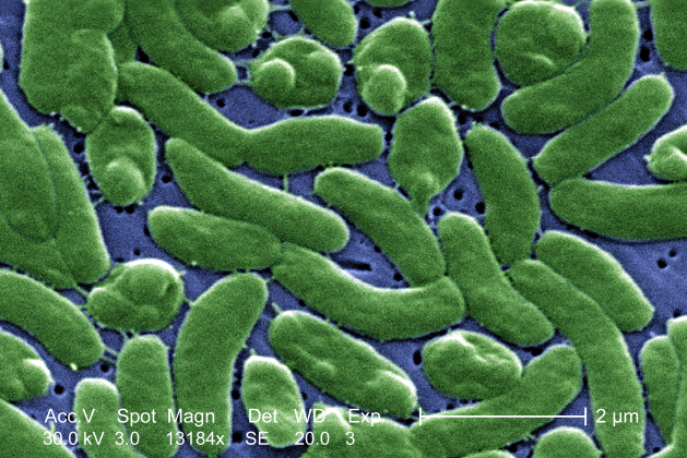 False color scanning electron micrograph of Vibrio vulnificus bacteria