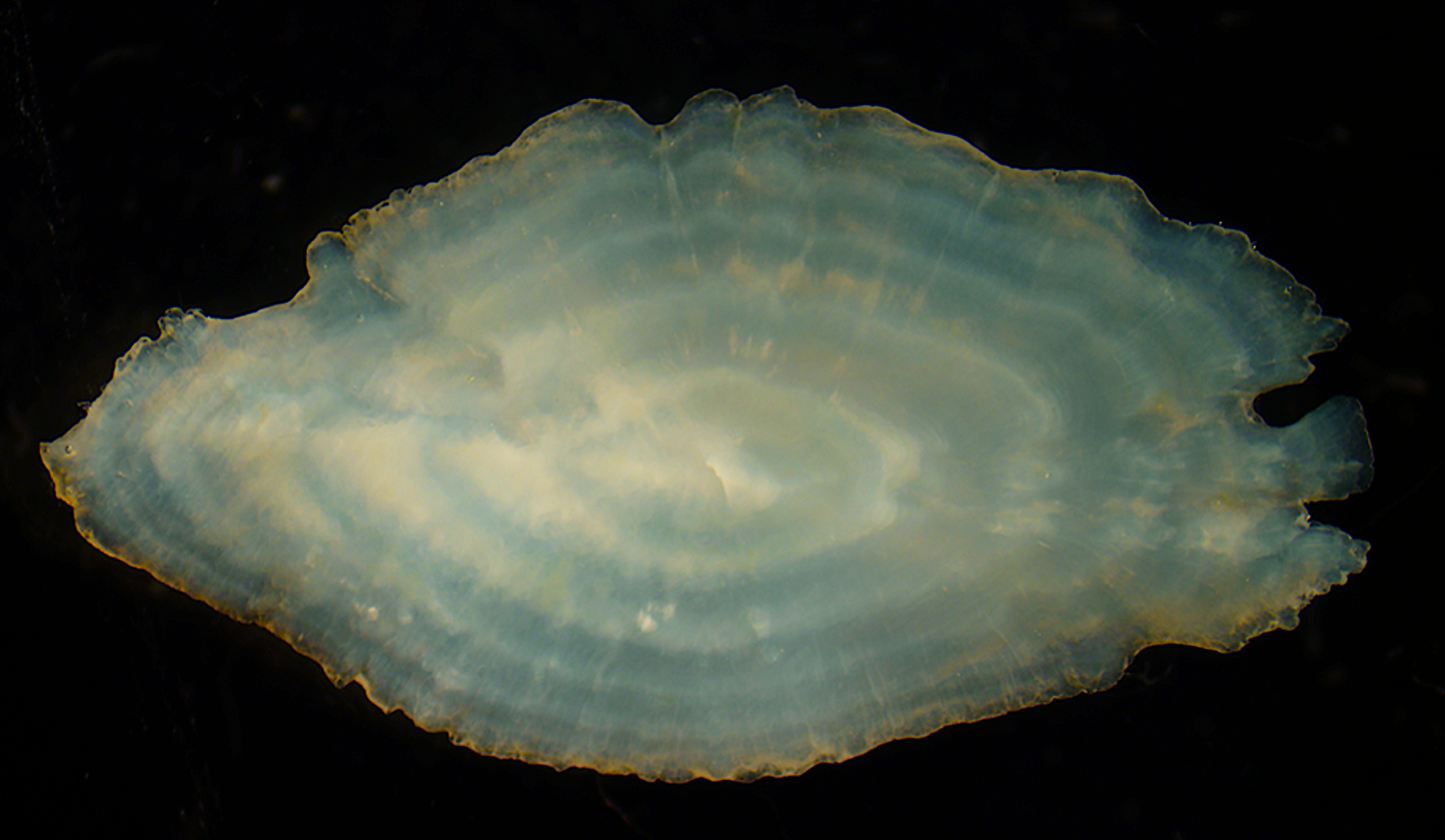image: Otolith cross-section.